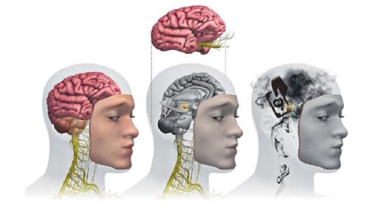 El cerebro del corrupto – Por Dr. Elmer Huerta