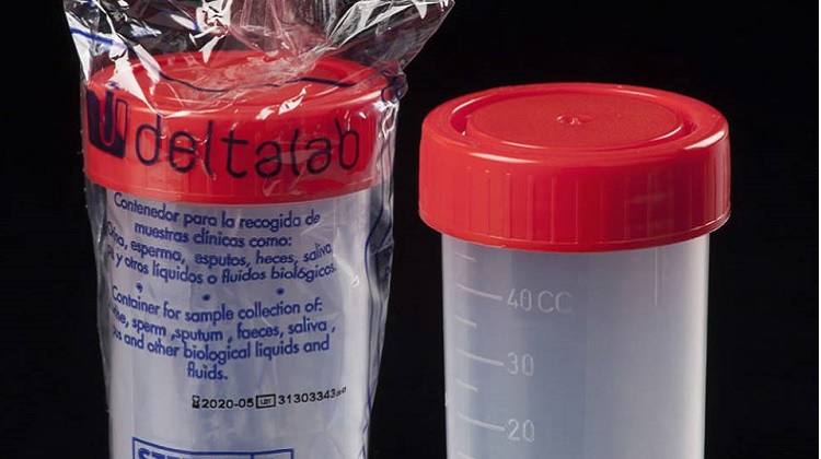 Unidad Ejecutora 401 de la Red de Salud Moyobamba habría realizado compra sobrevaluada