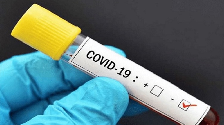 Coronavirus: Gobierno destina S/ 100 millones para compra de 1.6 millones de pruebas