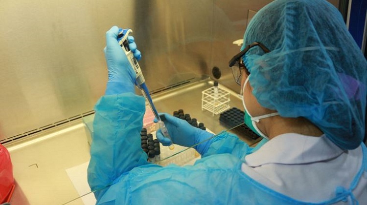 Coronavirus: Pruebas para detectar COVID-19 se estarían vendiendo con sobreprecio
