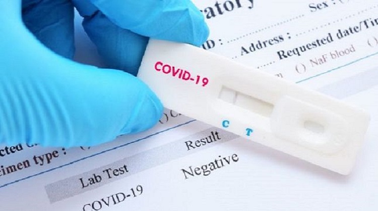 COVID-19: Perú compra pruebas rápidas con precios por encima del mercado