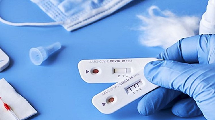 Perú Compras implementará Catálogo Electrónico de pruebas rápidas para covid-19