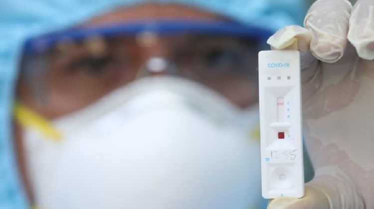 EsSalud: Contraloría advierte riesgo de perjuicio de S/ 4 millones en compra de kits para detectar la COVID-19