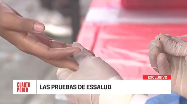 COVID-19: Compra de pruebas serológicas por parte del Essalud continúan bajo la lupa (Video)