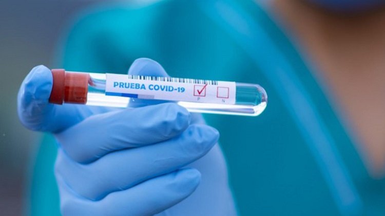 Perú Compras adquirirá 500,000 kits de detención molecular del covid-19