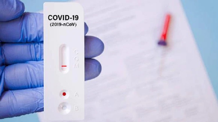 COVID-19: Unas 25 empresas importaron, vendieron o tomaron pruebas sin autorización