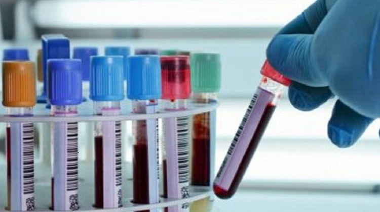 Perú Compras amplía convocatoria para nuevo catálogo de tubos hematológicos