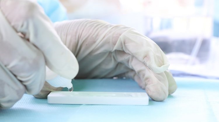 Contraloría revela que el Instituto Nacional de Salud gastó S/ 105 millones en pruebas rápidas de Covid-19 ineficaces