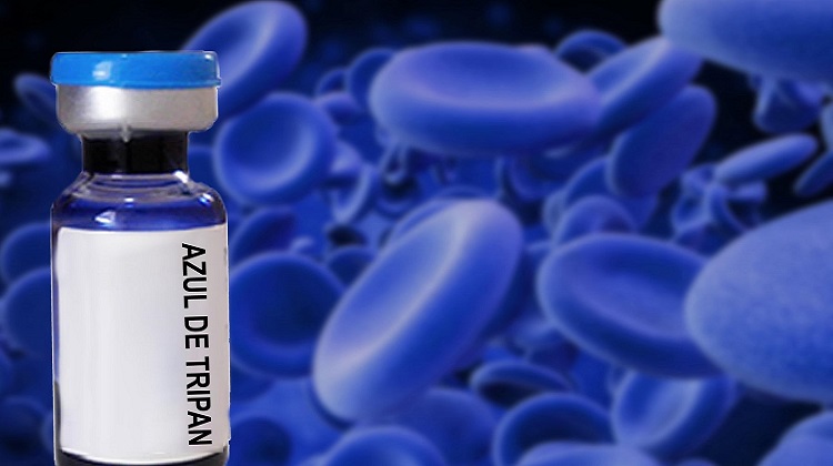 Perú Compras: se facilitará adquisición de material oftálmico para cataratas