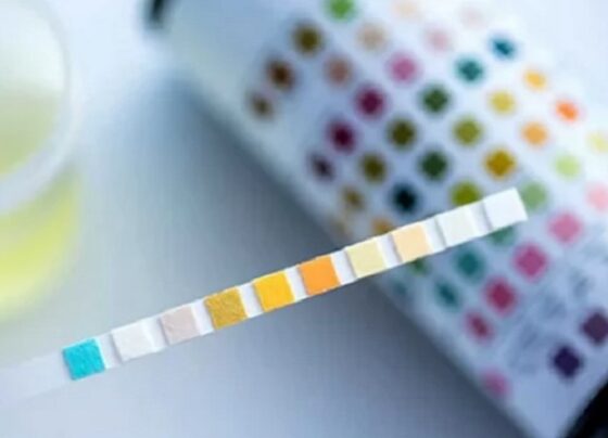Contraloría detecta irregularidades en compra de insumos médicos por la Red de Salud Puno