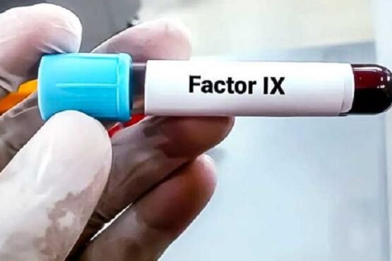 EsSalud concreta compra internacional de Factor IX para tratamiento de hemofilia B