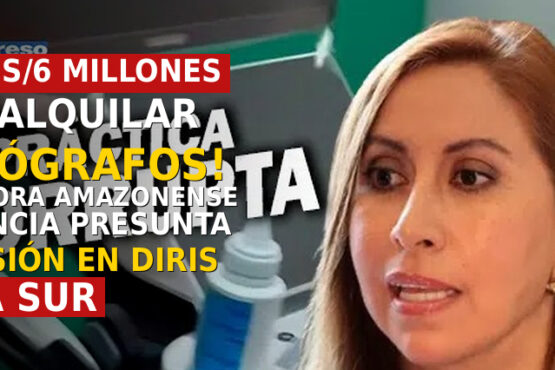¡Casi s/6 millones por alquilar 9 ecógrafos! senadora amazonense denuncia presunta colusión en Diris Lima Sur